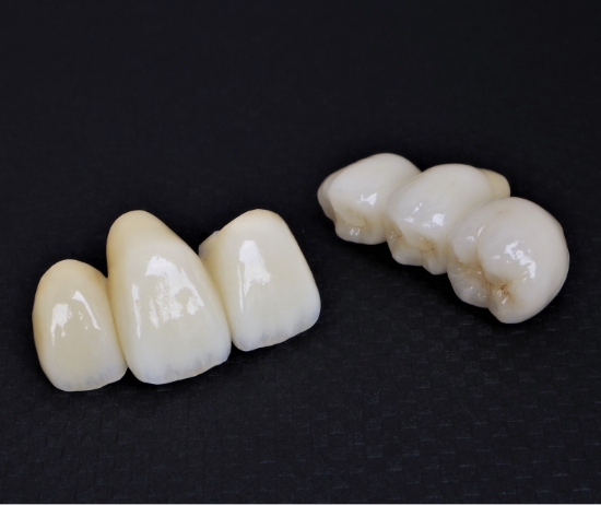 メタルフリー治療