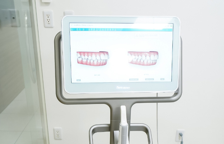 光学スキャナー「iTero」