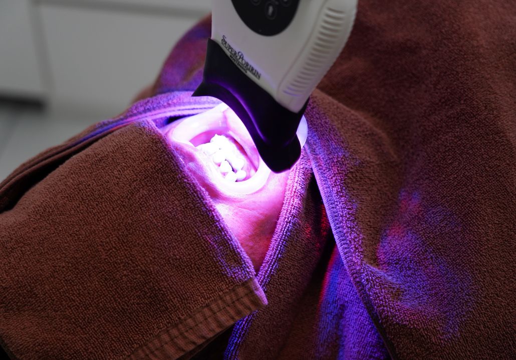 ホワイトニング