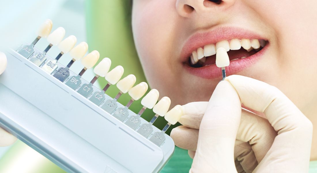 仕上げとチェック