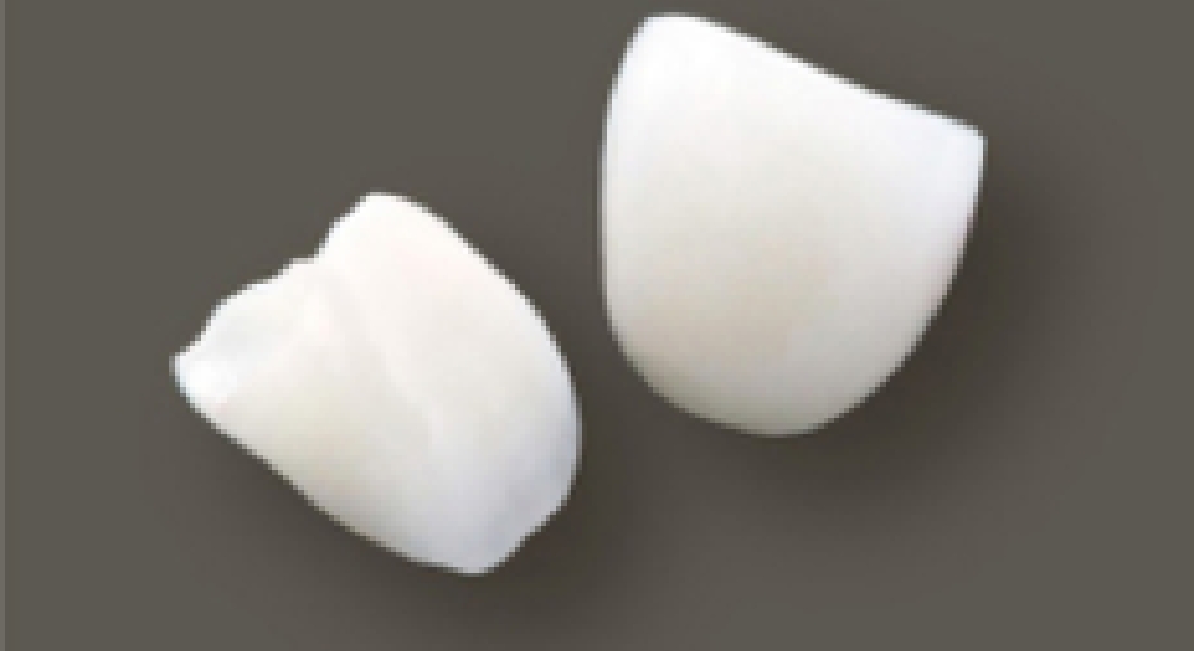 オールセラミック